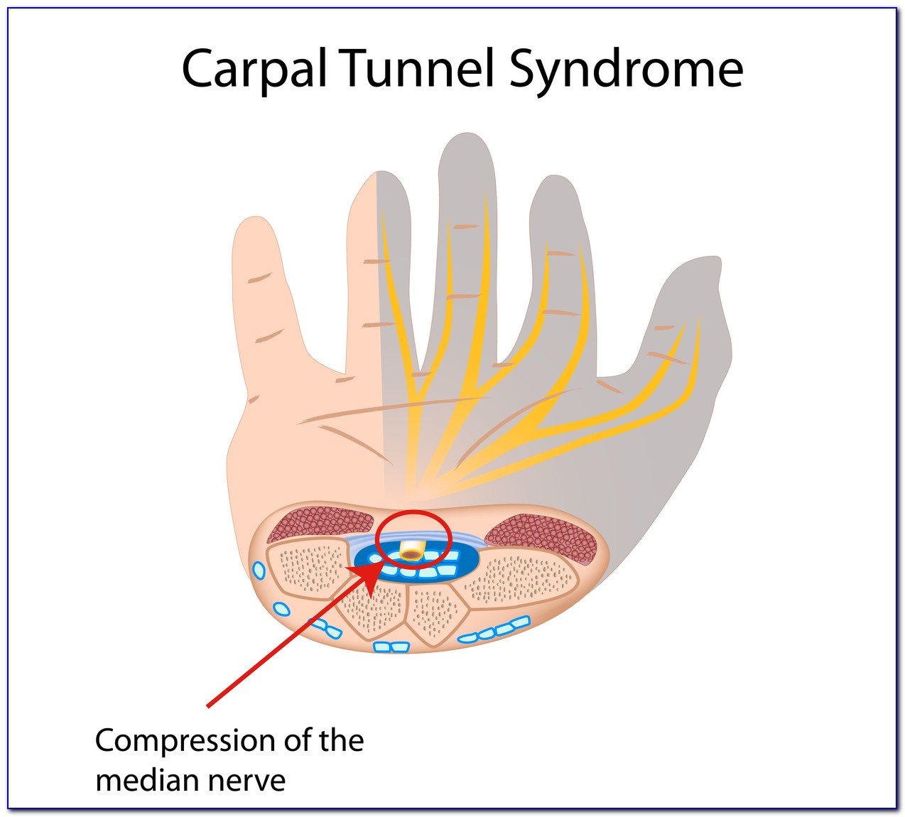 Carpal Tunnel Diagram Wrist