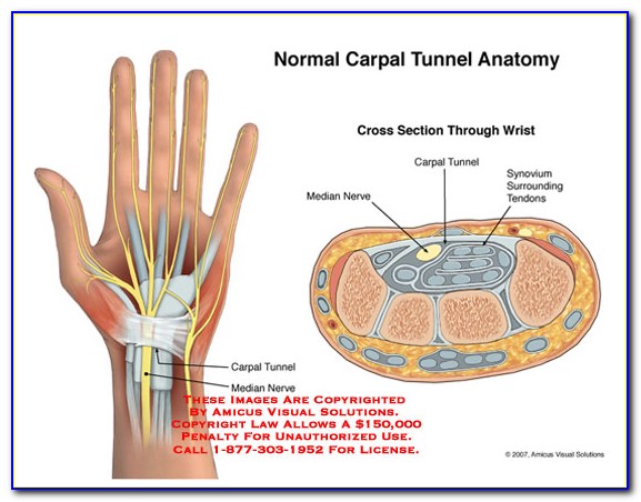Carpal Tunnel Symptoms Diagram