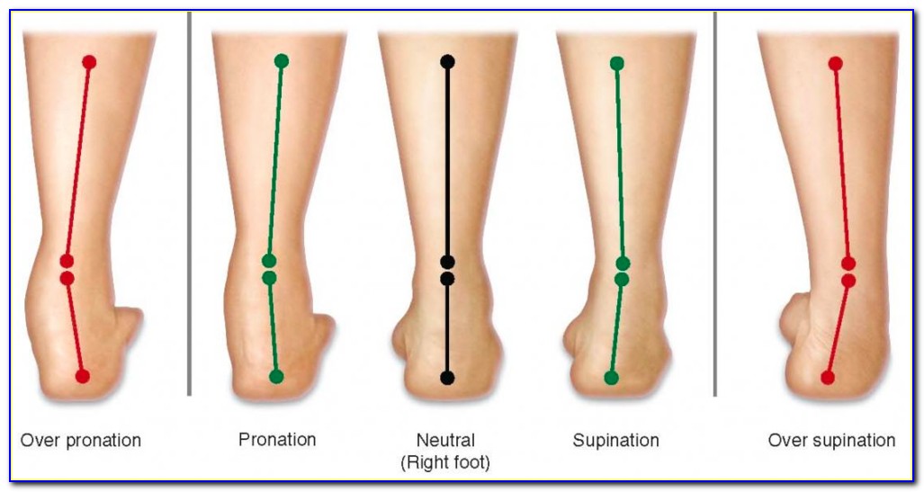 Achilles Heel Pain Diagram