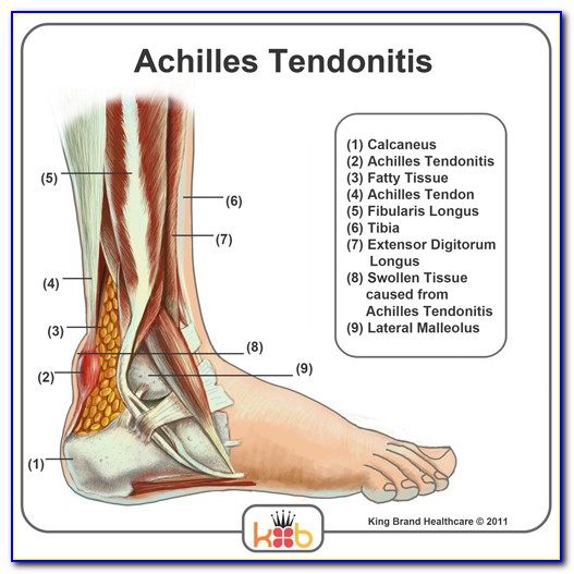 Achilles Tendon Diagram