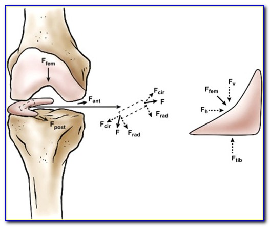 Meniscus Tear Anatomy Of The Knee